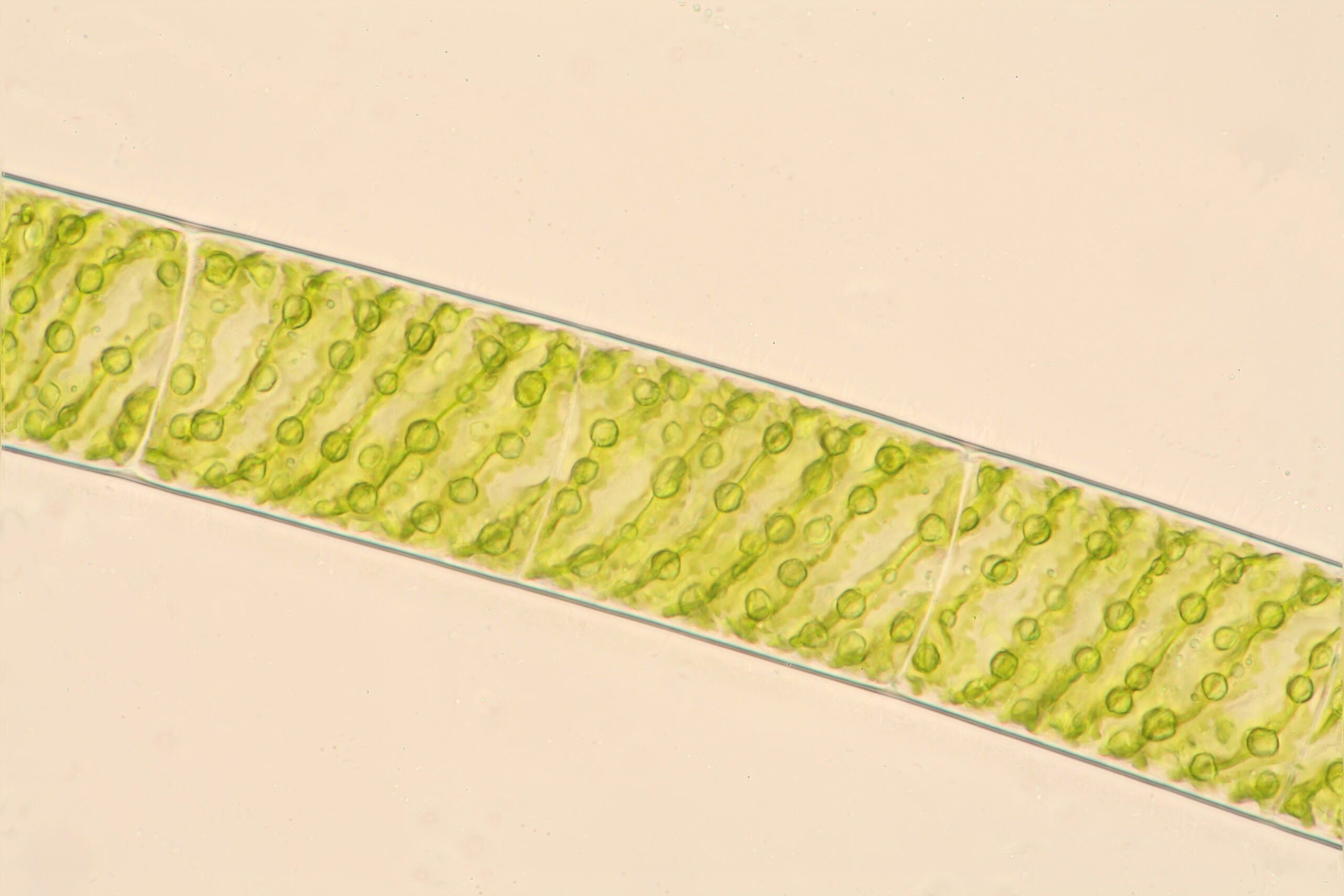 Single strand of Spirogyra